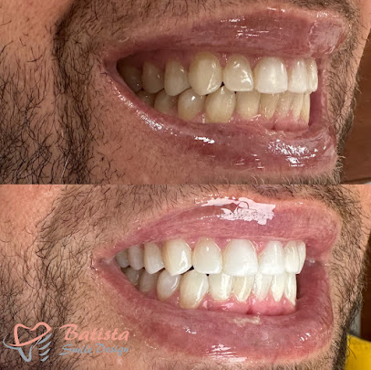 Batista Smile of Kendall