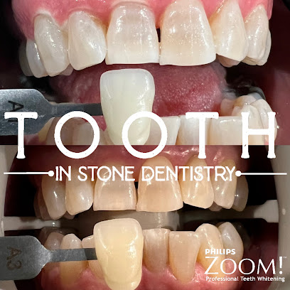 Tooth in Stone Dentistry of Richmond